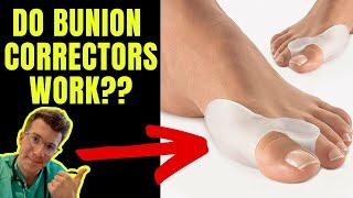 DO BUNION CORRECTORS WORK? Doctor explains...