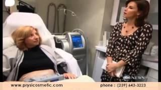 Coolsculpting - NightLine - Dr. Mark Prysi