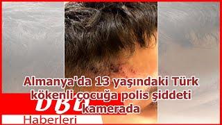 Almanyada 13 yaşındaki Türk kökenli çocuğa polis şiddeti kamerada