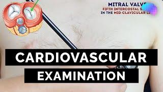 Cardiovascular Examination  OSCE Guide  UKMLA  CPSA