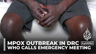 WHO calls emergency meeting to discuss jump in mpox cases from DRC