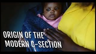 Did you know First Cesarean Section Surgeries were conducted in Tanzania