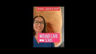 Scabs Wound Care  @LevelUpRN