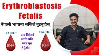 Understand Erythroblastosis Fetalis easily in Nepali Language 