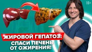 Опасность ЖИРНОЙ ПЕЧЕНИ Как лечить ЖИРОВОЙ ГЕПАТОЗ? Симптомы диагностика и ДИЕТА для печени