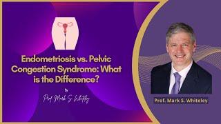 Endometriosis vs  Pelvic Congestion Syndrome What is the Difference by Prof  Mark Whiteley