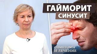 Как эффективно лечить гайморит? синусит