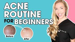 Acne Skincare Routine for Beginners  The Budget Dermatologist