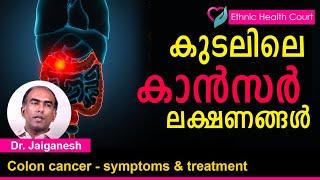 Colon cancer - symptoms & treatments  കുടലിലെ കാൻസർ എങ്ങനെ തിരിച്ചറിയാം? ലക്ഷണങ്ങൾ.