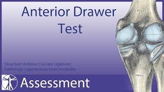 Anterior Drawer Test  Anterior Cruciate Ligament