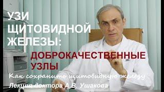 УЗИ Щитовидной железы Доброкачественные узлы щитовидки 4 варианта узлов. Лекция. Доктор Ушаков