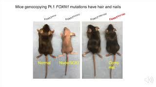 Characterization of FOXN1 mutation-mediated immune deficiency