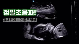 정밀초음파 검사 전에 보고 가세요  임신 21주 초음파  임신중기 정밀초음파  초음파 용어  성별 확정