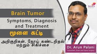 Brain Tumour- Symptoms Diagnosis and Treatment  மூளை கட்டி – அறிகுறிகள் கண்டறிதல் மற்றும் சிகிச்சை