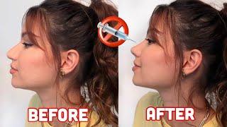 AT HOME RHINOPLASTY IN MINUTES No surgery No filler