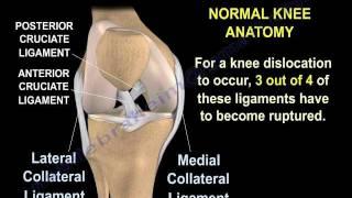 Knee Dislocations - Everything You Need To Know - Dr. Nabil Ebraheim