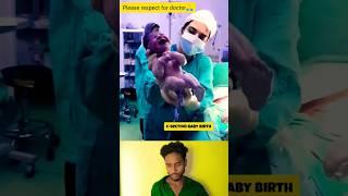 C-section delivery baby birth  #junior #birth #respectmother #painful #emotional #shortsviral