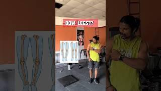 how to correct bow legs?? #gym #fitness #bodybuilding #motivation #bowlegs #workoutmotivation