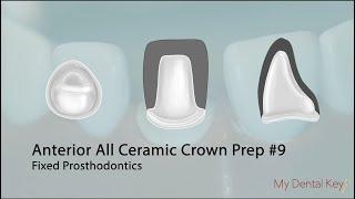 PASS THE CDCA - All Ceramic Anterior Crown Preparation  My Dental Key
