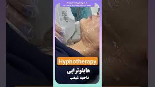 #Hyphotherapy دکترمیمندمتخصص  هایفوتراپی کرج #skincare #پوست_مو پوست مو کرج #هایفوتراپی #رفع_غبغب