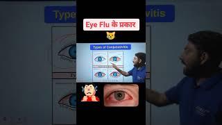 Types of Eye Flu  Eye Flu Treatment #conjunctivitis #conjunctivitistreatment #pinkeye #aankaana 🩸