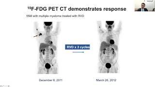 Updates on Managing Bone Disease in Multiple Myeloma