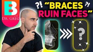 Braces Extractions DO NOT Ruin Faces