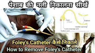 Urinary Catheter Remove कैसे करें  How to remove foleys Catheter  Foleys Catheter कैसे निकाले