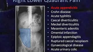 evaluation of acute abdomen by CT