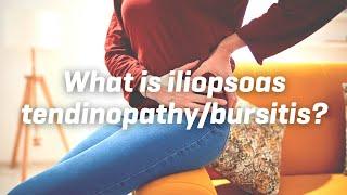 What is iliopsoas tendinopathybursitis?