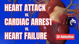 The Difference Between Cardiac Arrest Heart Attack and Heart Failure - 3D Animation