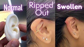 Jonys Vlog 014 Her Helix Piercing Ripped Through her Ear