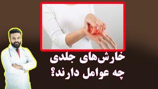 خارش های جلدی چه عوامل دارند و چگونه درمان می شوند؟ داکتر قیس نیکزاد