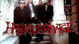 Haemorrhage - Hypochondriac