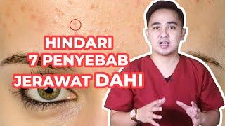 Ternyata ini 7 penyebab Jerawat Dahi muncul terus