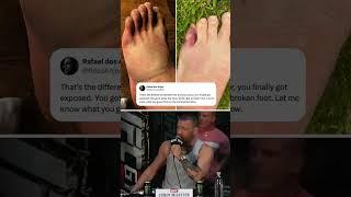 RDA responded to Conor’s broken toe  #UFC303