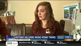 Mothers pregnancy journey with Mono Mono twins - Medical Minute