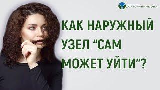 НАРУЖНЫЙ ГЕМОРРОЙ. Как наружный узел сам может уйти