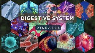 Digestive Diseases Explained - Causes Symptoms & Treatments