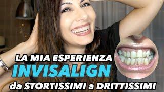 INVISALIGN  da STORTISSIMI a DRITTISSIMI - LA MIA ESPERIENZA e rispondo a tutte le VOSTRE DOMANDE