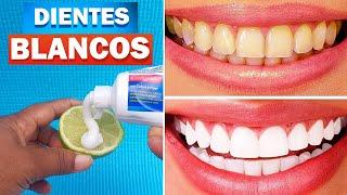  3 Ways to HOME WHITEN TEETH and Remove spots in minutes