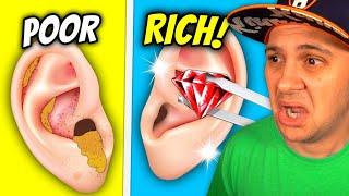 From POOR To RICH In Earwax Clinic