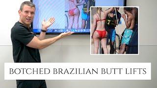 Botched Brazilian Butt Lifts  Dr. Barrett Breaks Down Terrible Plastic Surgery Results