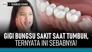 Kenapa Gigi Bungsu Terasa Sakit saat Tumbuh? Ini Fakta Uniknya  Hidup Sehat tvOne