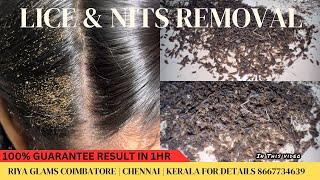 How to remove Lice from Hairhow to remove Lice permanentlyhow to prevent from LiceLice removal￼