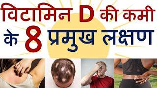 विटामिन डी की कमी के प्रमुख लक्षण।Symptoms of Vitamin D3 deficiency।Apme to nahi Vitamin D ki kami ?