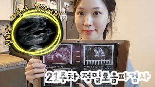 pregnant VLOG21st week pregnant test my baby is boy