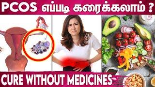Natural Treatment For PCOS  Causes of Polycystic Ovarian Syndrome  Irregular Periods