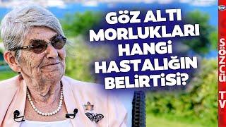 Göz Altı Morlukları Neden Olur? Canan Karatay Çok Büyük Belirti Diyerek Anlattı