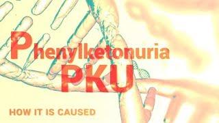 Phenylketonuria  PKU  Mental Retardation  Phenylalanine Hydroxylase